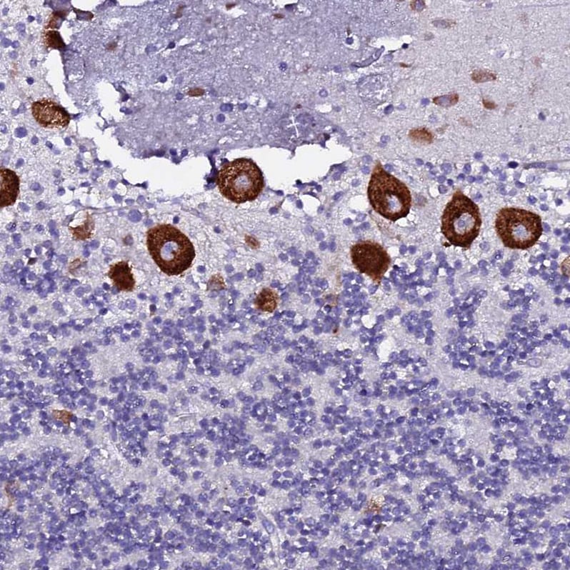 EEF1G Antibody - BSA Free Immunohistochemistry: EEF1G Antibody - BSA Free [NBP1-91862]