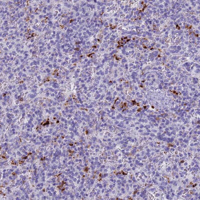 Eosinophil derived neurotoxin Antibody - BSA Free Immunohistochemistry: Eosinophil derived neurotoxin Antibody - BSA Free [NBP1-91872]