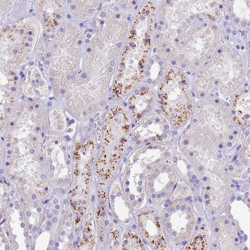 Eosinophil derived neurotoxin Antibody - BSA Free Immunohistochemistry: Eosinophil derived neurotoxin Antibody - BSA Free [NBP1-91872]