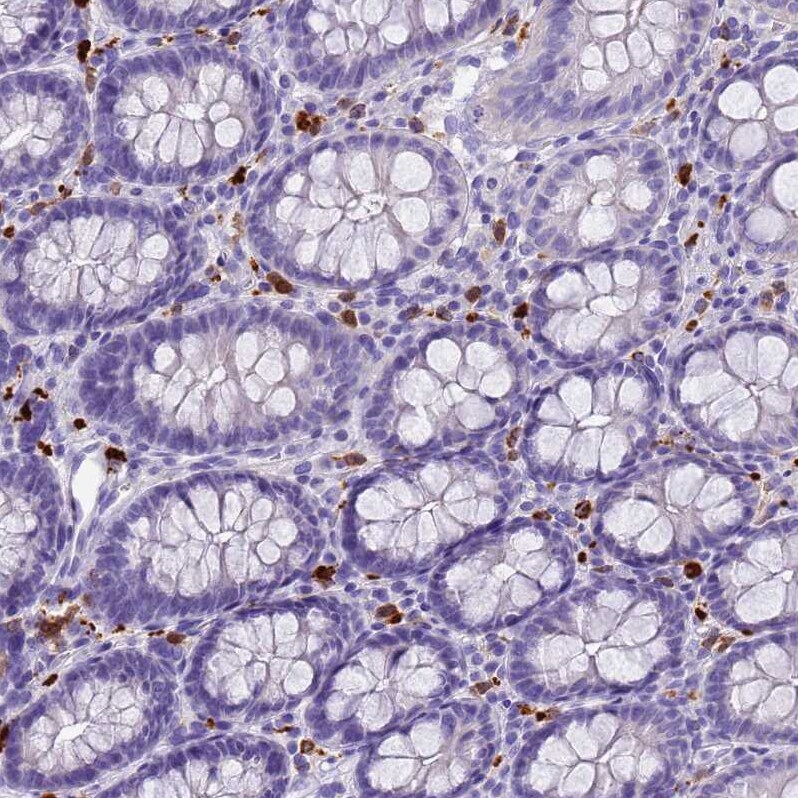 Eosinophil derived neurotoxin Antibody - BSA Free Immunohistochemistry: Eosinophil derived neurotoxin Antibody - BSA Free [NBP1-91872]