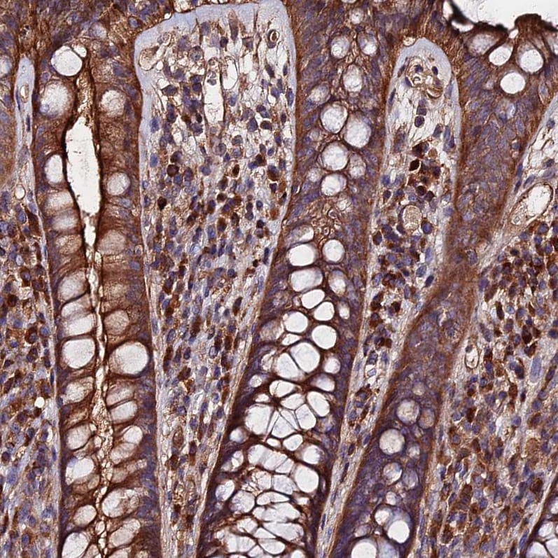 Exostosin 1 Antibody - BSA Free Immunohistochemistry: Exostosin 1 Antibody - BSA Free [NBP1-91875]