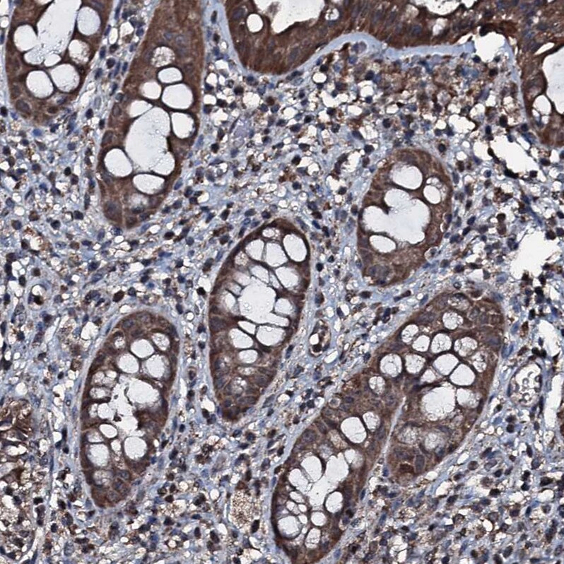 FAAP24 Antibody - BSA Free Immunohistochemistry: FAAP24 Antibody - BSA Free [NBP1-91876]