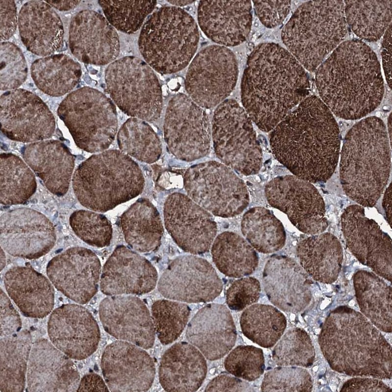 FAAP24 Antibody - BSA Free Immunohistochemistry: FAAP24 Antibody - BSA Free [NBP1-91876]