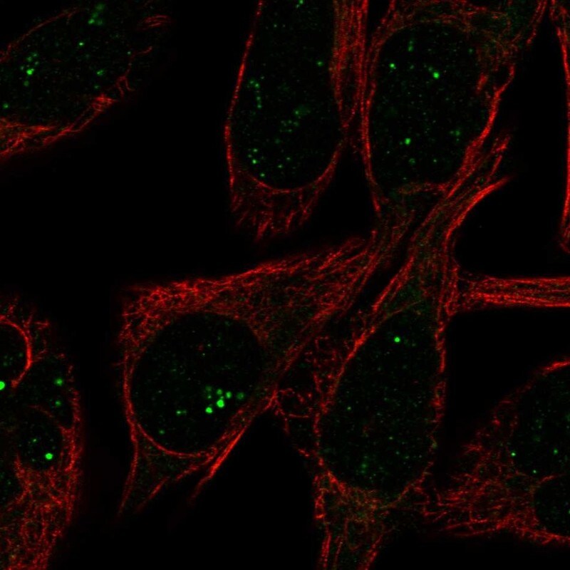 FADS3 Antibody - BSA Free Immunocytochemistry/ Immunofluorescence: FADS3 Antibody - BSA Free [NBP1-91877]