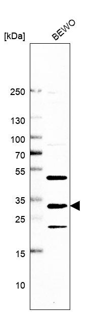FAM125A Antibody - BSA Free Western Blot: FAM125A Antibody - BSA Free [NBP1-91882]