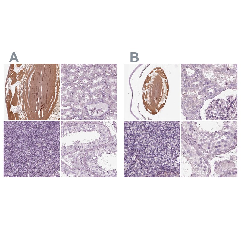Filensin Antibody - BSA Free Immunohistochemistry-Paraffin: Filensin Antibody [NBP1-91902]