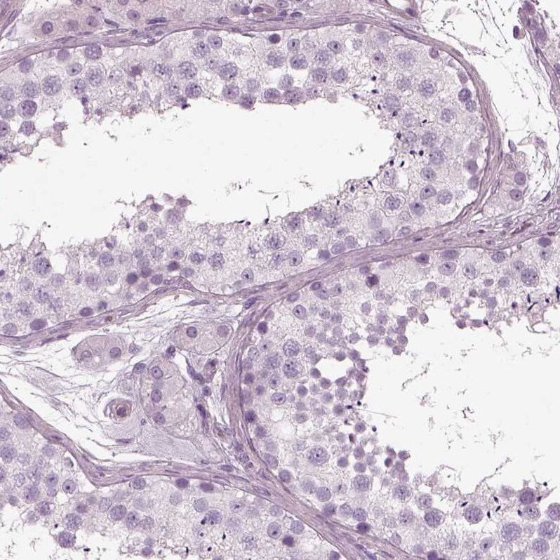 Filensin Antibody - BSA Free Immunohistochemistry: Filensin Antibody - BSA Free [NBP1-91902]