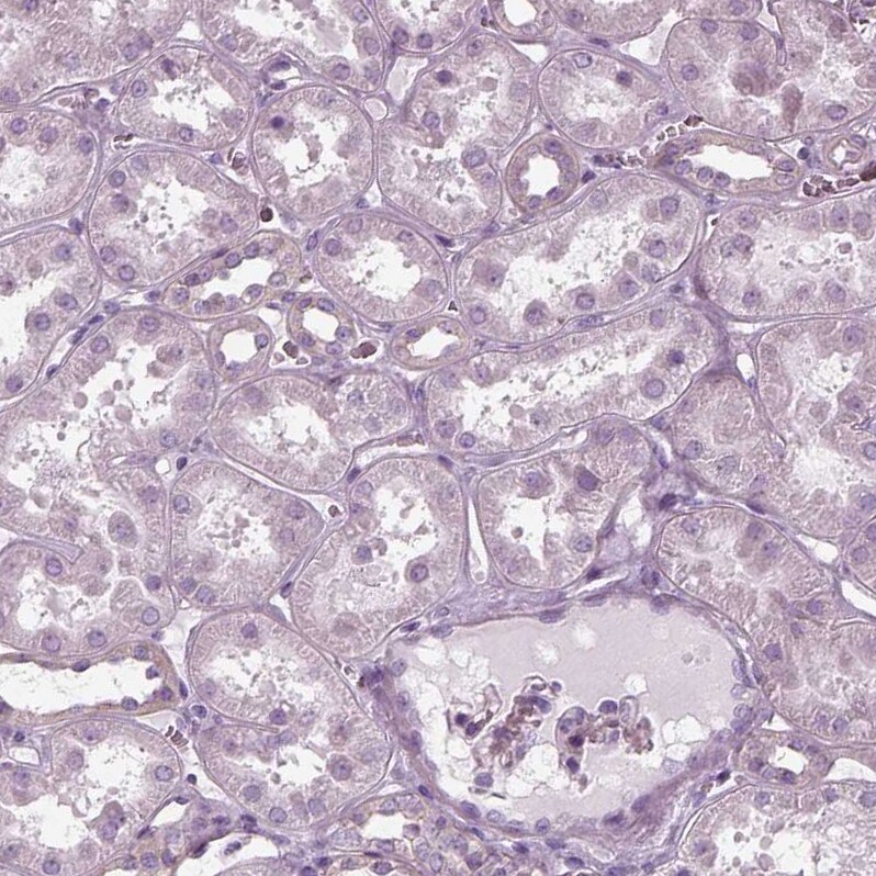Filensin Antibody - BSA Free Immunohistochemistry: Filensin Antibody - BSA Free [NBP1-91902]