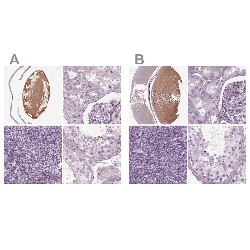 Filensin Antibody Immunohistochemistry-Paraffin: Filensin Antibody Antibody [NBP1-91903]