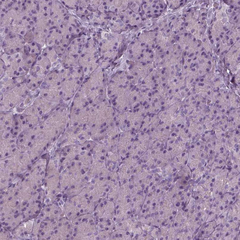 TMEM231 Antibody Immunohistochemistry: TMEM231 Antibody [TMEM231 Antibody]