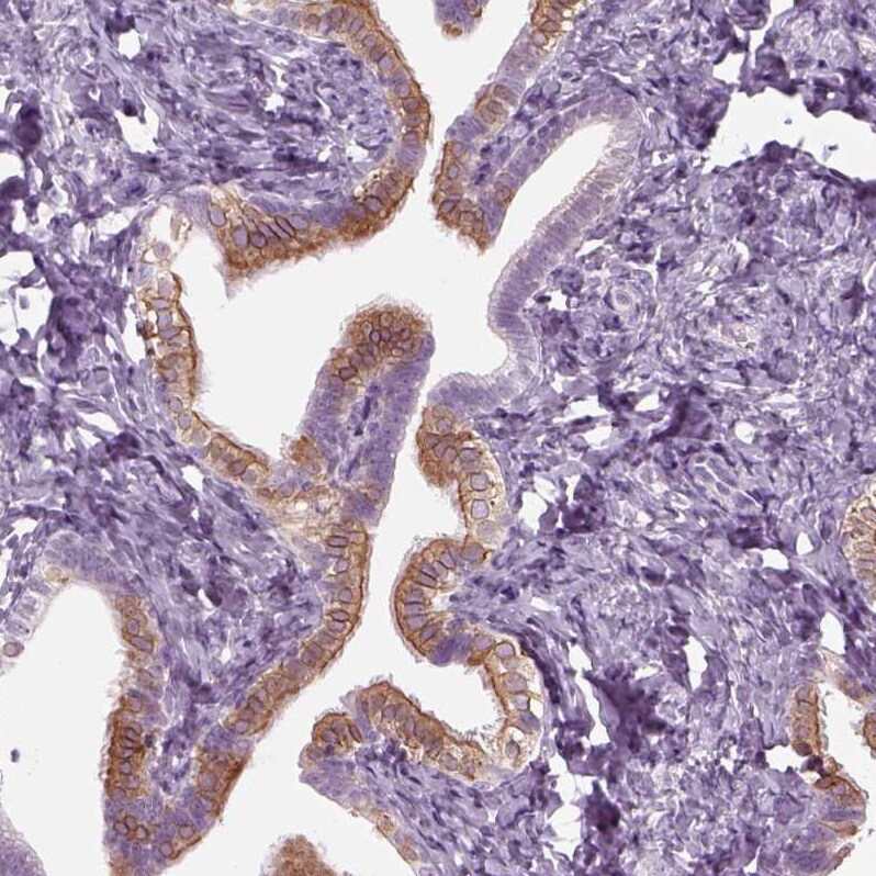 TMEM231 Antibody Immunohistochemistry: TMEM231 Antibody [TMEM231 Antibody]