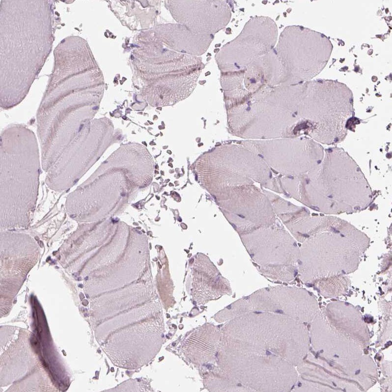 TMEM231 Antibody Immunohistochemistry: TMEM231 Antibody [TMEM231 Antibody]