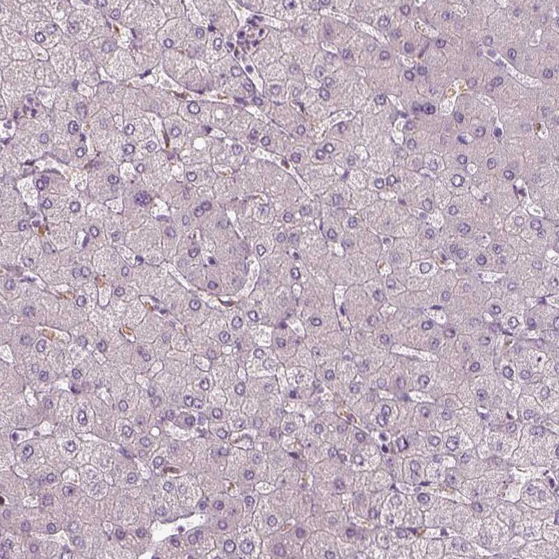 TMEM231 Antibody Immunohistochemistry: TMEM231 Antibody [TMEM231 Antibody]