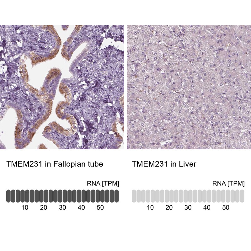 TMEM231 Antibody Immunohistochemistry: TMEM231 Antibody [TMEM231 Antibody]