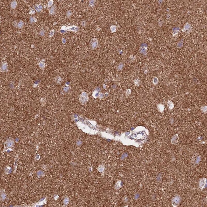 FRMPD1 Antibody - BSA Free Immunohistochemistry: FRMPD1 Antibody - BSA Free [NBP1-91912]
