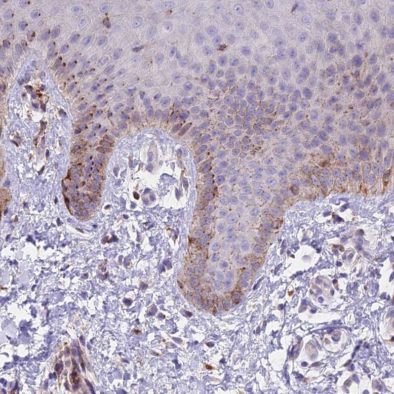 FRMPD1 Antibody - BSA Free Immunohistochemistry: FRMPD1 Antibody - BSA Free [NBP1-91912]