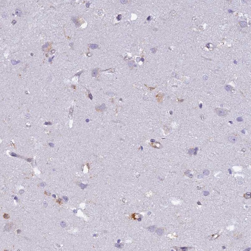 FYB/ADAP/SLAP130 Antibody - BSA Free Immunohistochemistry: FYB/ADAP/SLAP130 Antibody - BSA Free [NBP1-91916]