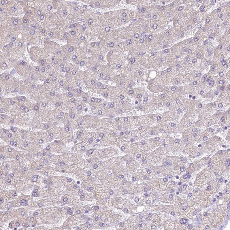 GAT3 Antibody - BSA Free Immunohistochemistry: GAT3 Antibody - BSA Free [NBP1-91920]