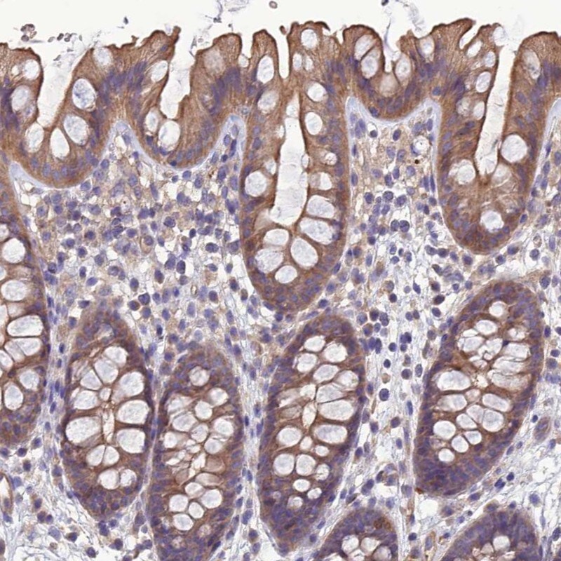 Galanin R2/GALR2 Antibody - BSA Free Immunohistochemistry: Galanin R2/GALR2 Antibody - BSA Free [NBP1-91921]