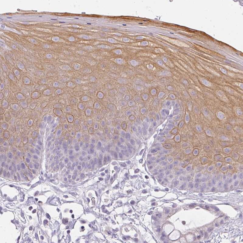 Gasdermin-C Antibody - BSA Free Immunohistochemistry: Gasdermin-C Antibody - BSA Free [NBP1-91926]