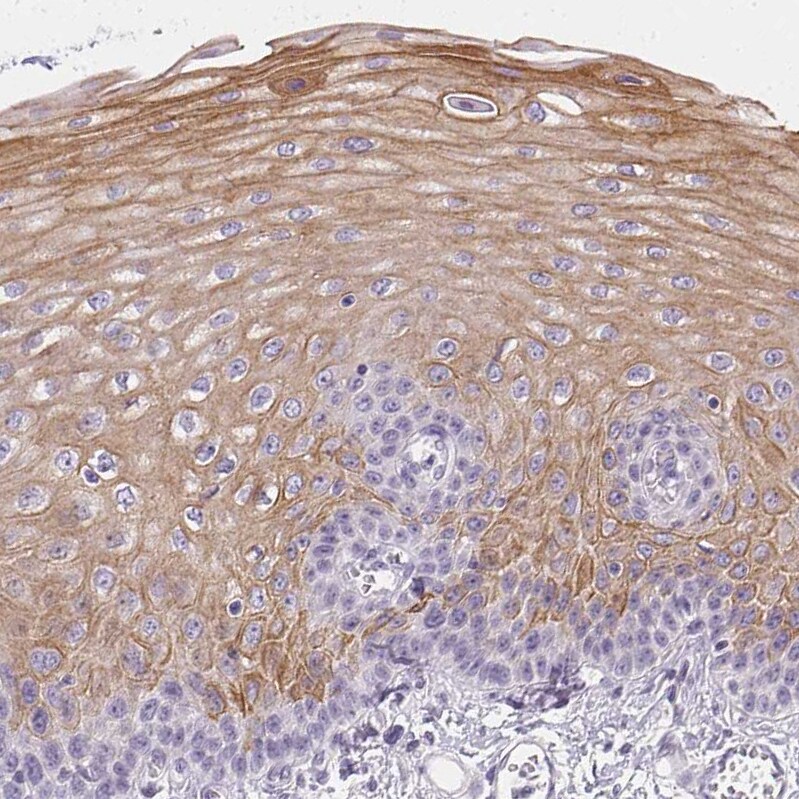 Gasdermin-C Antibody - BSA Free Immunohistochemistry: Gasdermin-C Antibody - BSA Free [NBP1-91926]