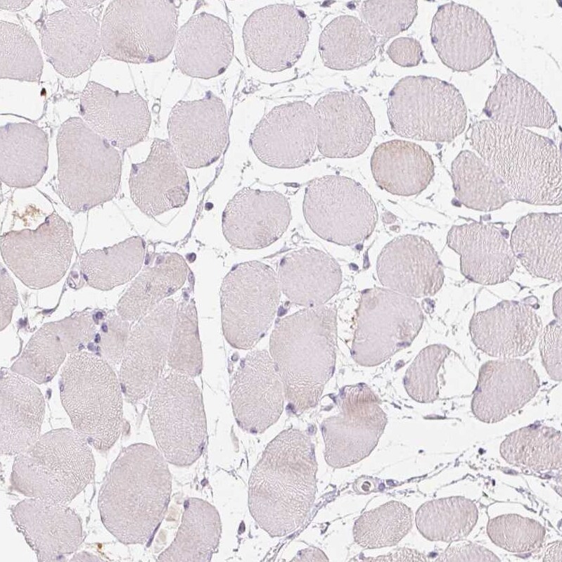 Gasdermin-C Antibody - BSA Free Immunohistochemistry: Gasdermin-C Antibody - BSA Free [NBP1-91926]
