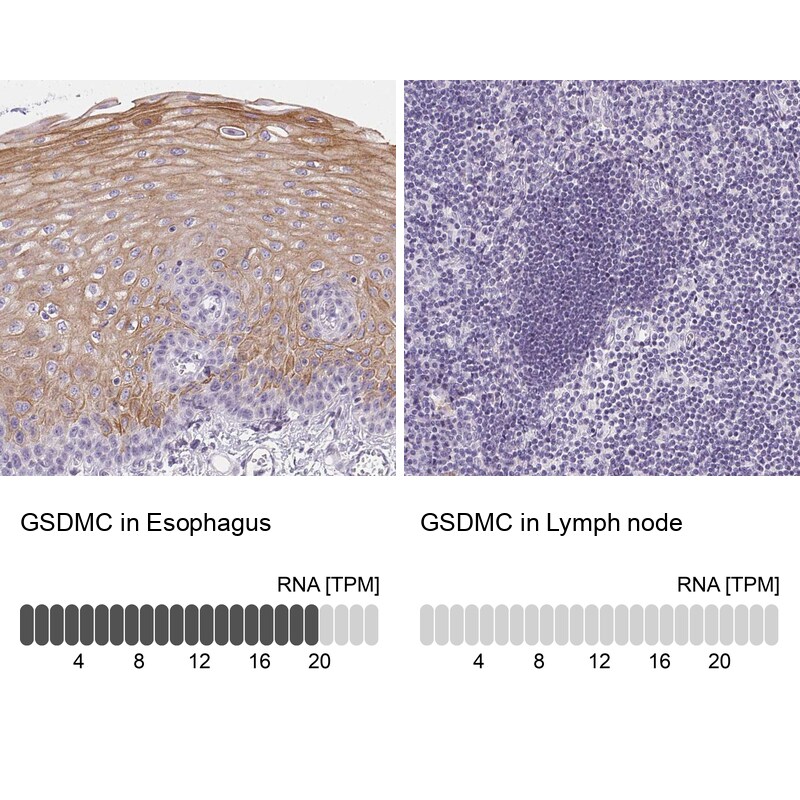 Gasdermin-C Antibody - BSA Free Immunohistochemistry: Gasdermin-C Antibody - BSA Free [NBP1-91926]