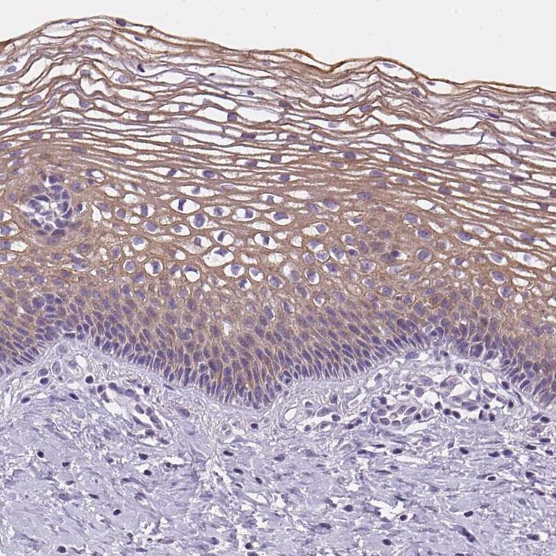 Gasdermin-C Antibody - BSA Free Immunohistochemistry: Gasdermin-C Antibody - BSA Free [NBP1-91926]