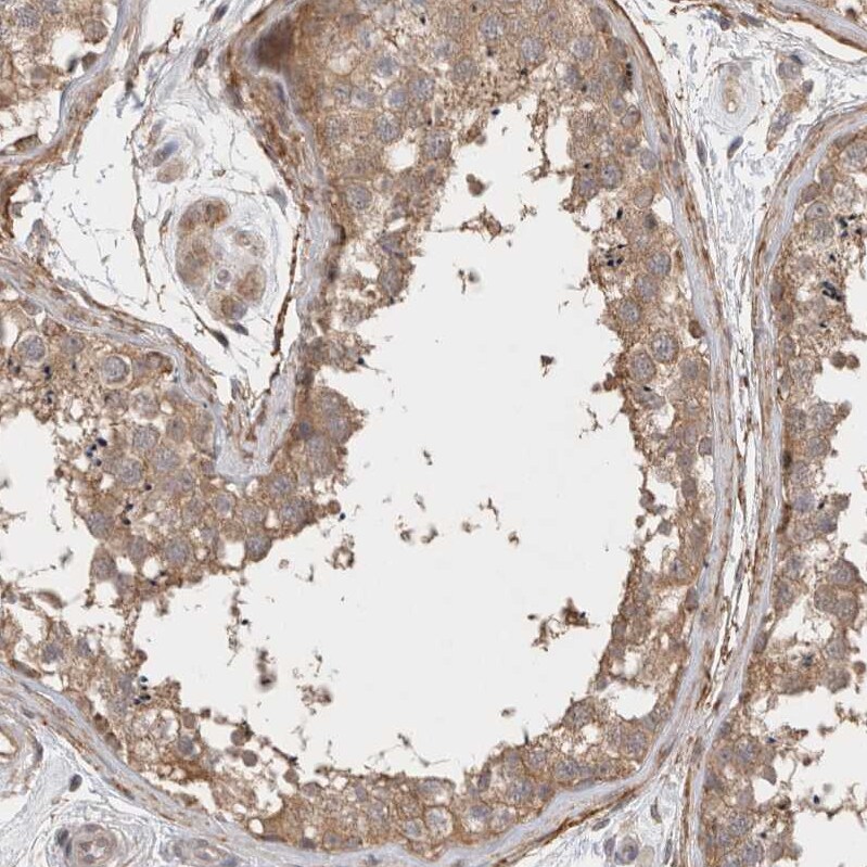 Gasdermin like Antibody - BSA Free Immunohistochemistry: Gasdermin like Antibody - BSA Free [NBP1-91927]