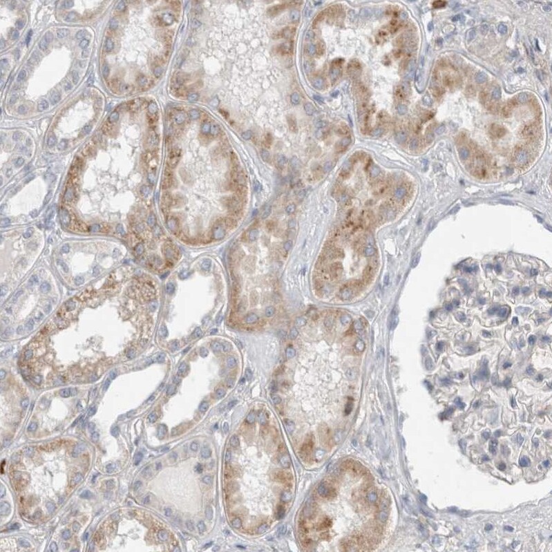 Gasdermin like Antibody - BSA Free Immunohistochemistry: Gasdermin like Antibody - BSA Free [NBP1-91927]