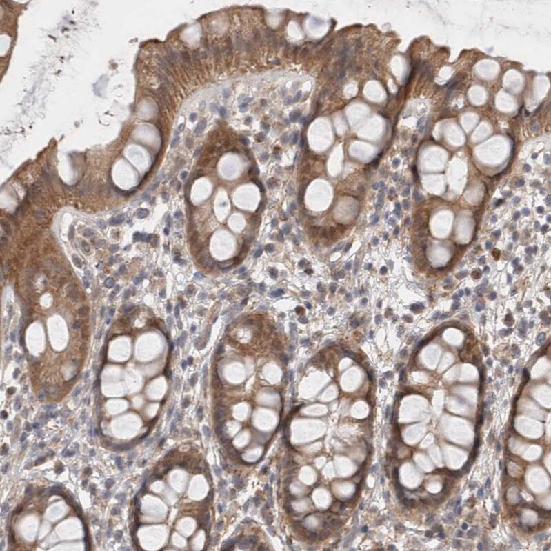 Gasdermin like Antibody - BSA Free Immunohistochemistry: Gasdermin like Antibody - BSA Free [NBP1-91927]