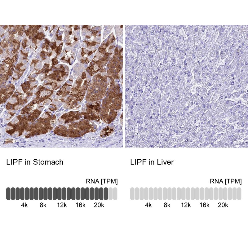 Gastric Lipase Antibody - BSA Free Immunohistochemistry: Gastric Lipase Antibody - BSA Free [NBP1-91928]