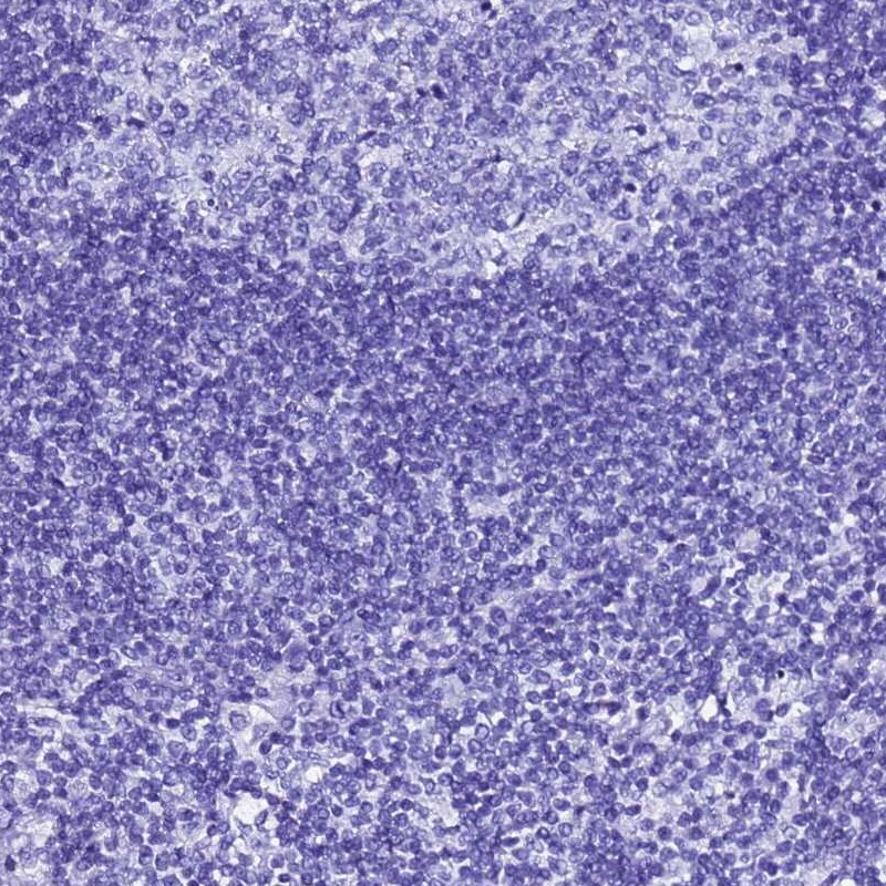 Gastric Lipase Antibody - BSA Free Immunohistochemistry: Gastric Lipase Antibody - BSA Free [NBP1-91928]
