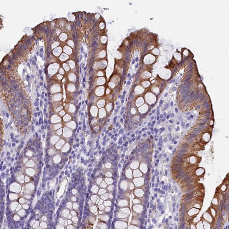 GCAP3 Antibody - BSA Free Immunohistochemistry-Paraffin: GCAP3 Antibody [NBP1-91930]