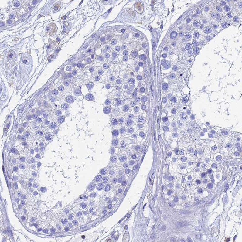 GCHFR Antibody - BSA Free Immunohistochemistry: GCHFR Antibody - BSA Free [NBP1-91931]