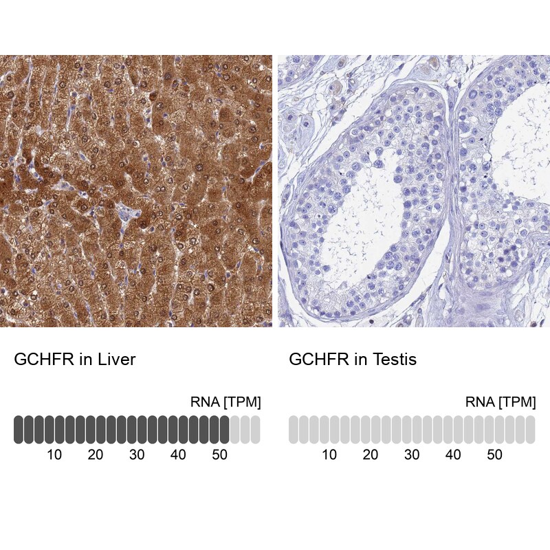 GCHFR Antibody - BSA Free Immunohistochemistry: GCHFR Antibody - BSA Free [NBP1-91931]