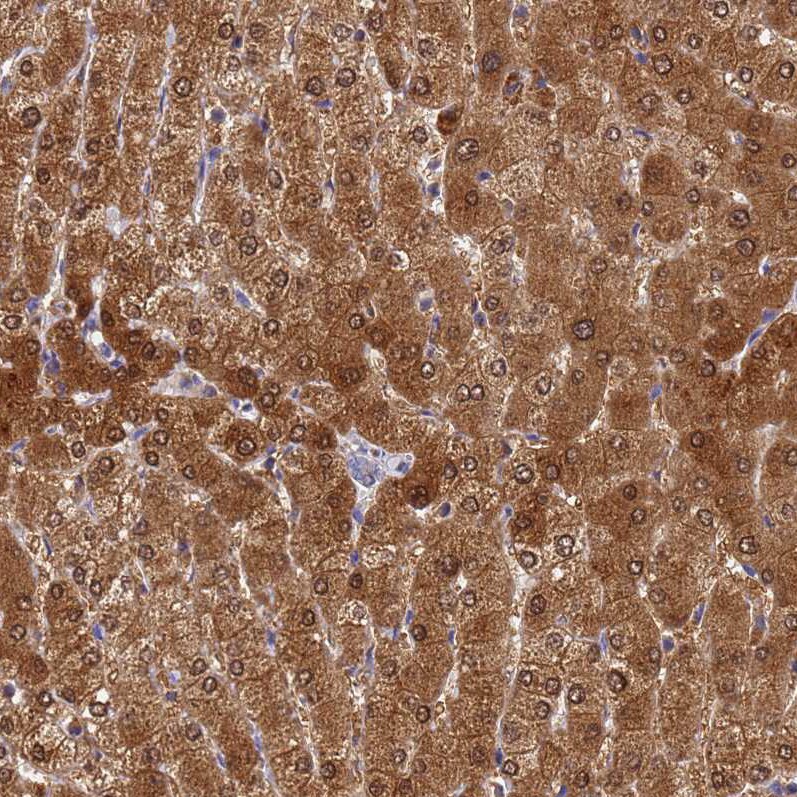 GCHFR Antibody - BSA Free Immunohistochemistry: GCHFR Antibody - BSA Free [NBP1-91931]