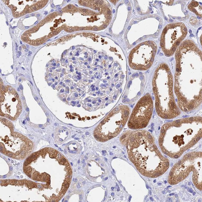GCHFR Antibody - BSA Free Immunohistochemistry: GCHFR Antibody - BSA Free [NBP1-91931]