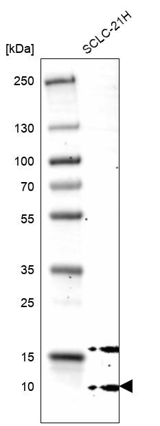GCHFR Antibody - BSA Free Western Blot: GCHFR Antibody - BSA Free [NBP1-91931]