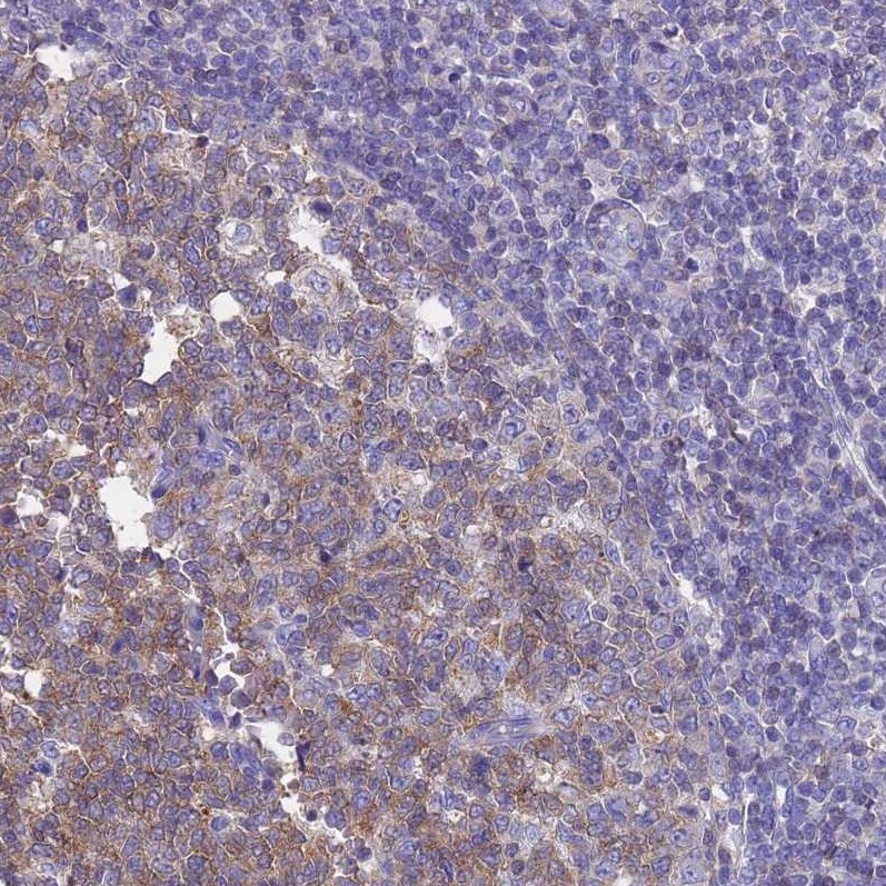 GCHFR Antibody - BSA Free Immunohistochemistry: GCHFR Antibody - BSA Free [NBP1-91931]