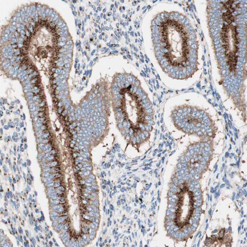 GOLGB1/Giantin Antibody - BSA Free Immunohistochemistry: GOLGB1/Giantin Antibody - BSA Free [NBP1-91937]