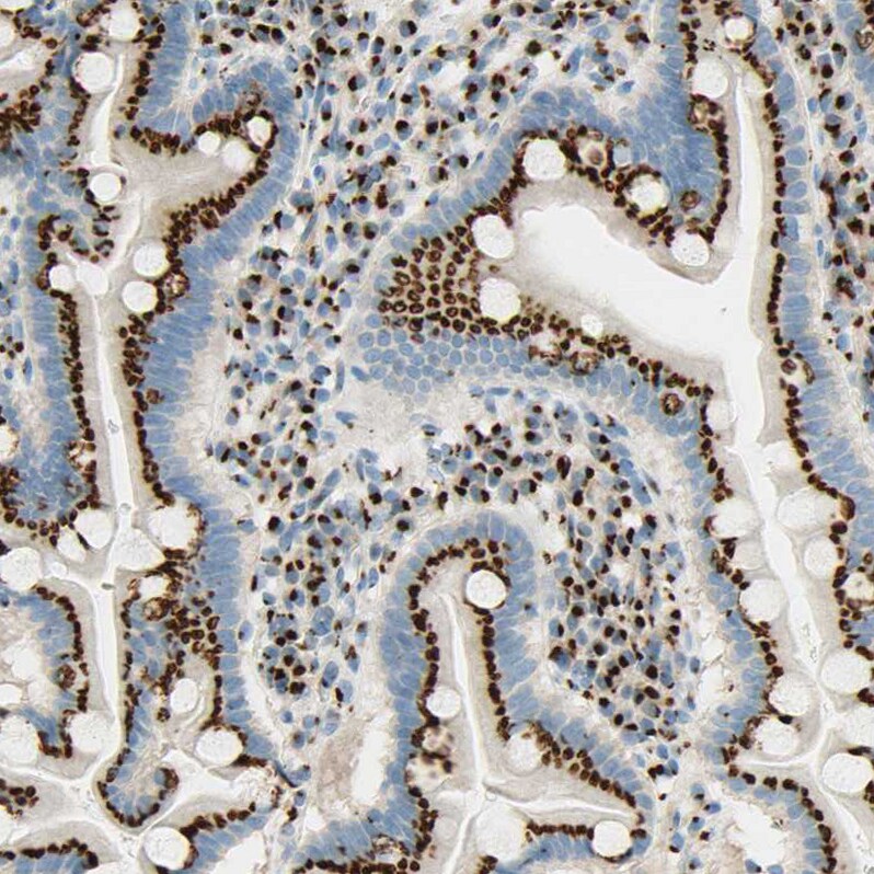 GOLGB1/Giantin Antibody - BSA Free Immunohistochemistry: GOLGB1/Giantin Antibody - BSA Free [NBP1-91938]