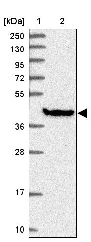 GIMAP1 Antibody - BSA Free Western Blot: GIMAP1 Antibody - BSA Free [NBP1-91940]
