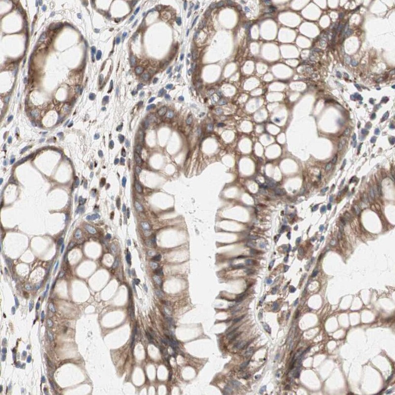 Glucose 1-dehydrogenase Antibody - BSA Free Immunohistochemistry: Glucose 1-dehydrogenase Antibody - BSA Free [NBP1-91942]