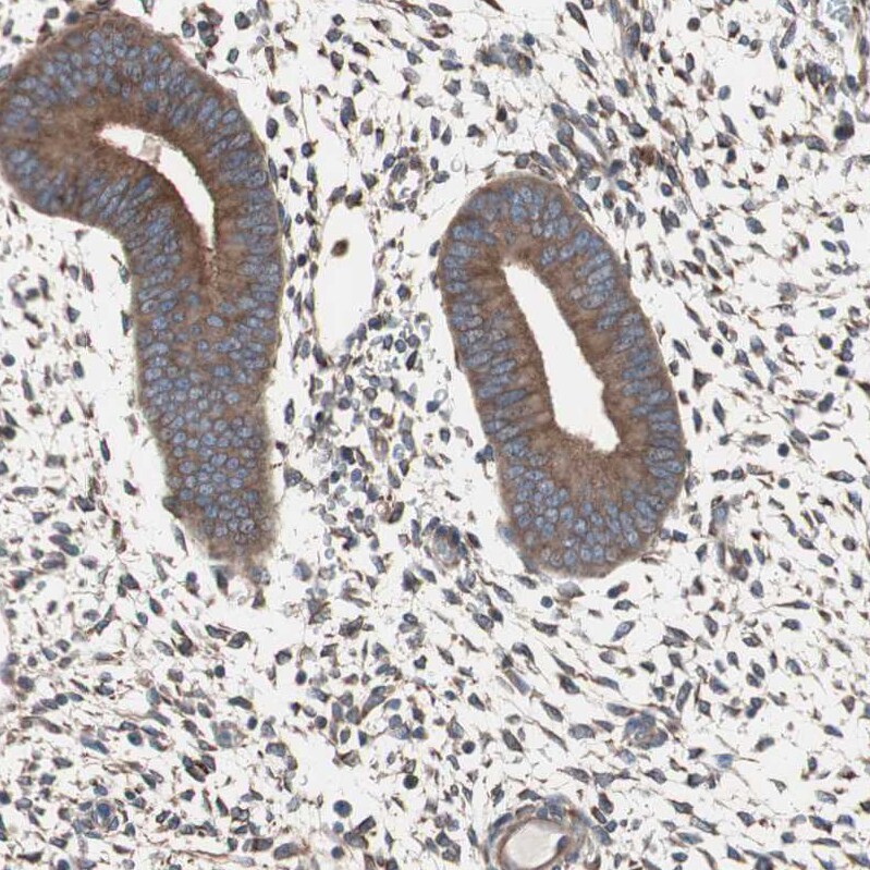 Glucose 1-dehydrogenase Antibody - BSA Free Immunohistochemistry: Glucose 1-dehydrogenase Antibody - BSA Free [NBP1-91942]