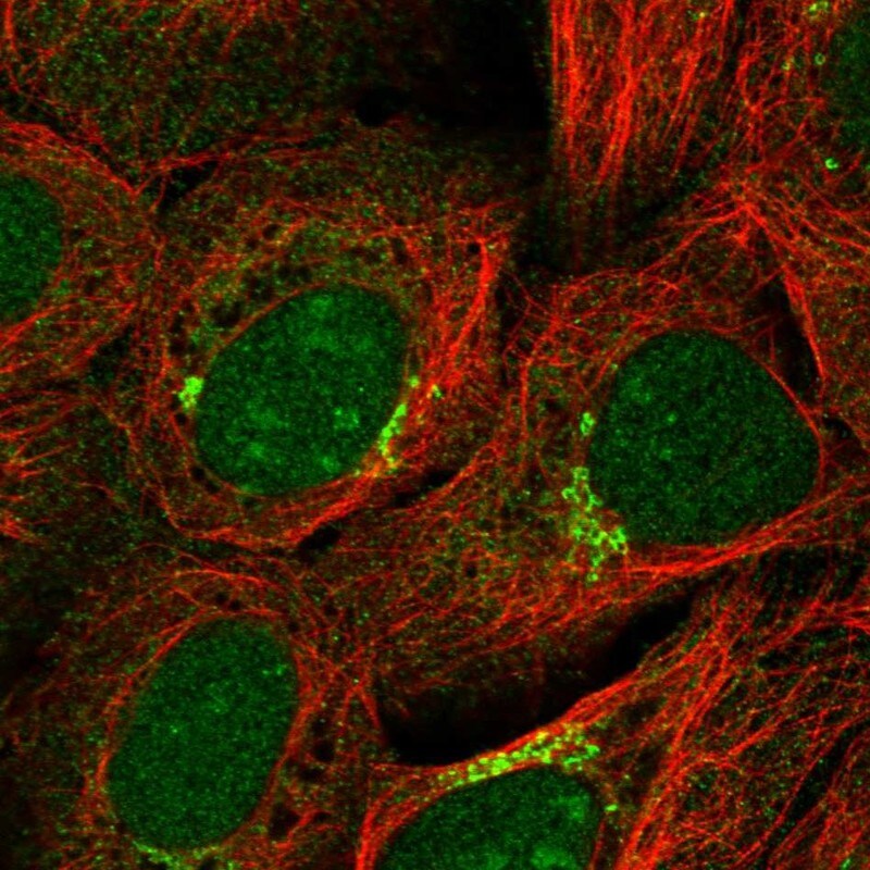 Gonadotropin Inducible Transcription Repressor 1 Antibody - BSA Free Immunocytochemistry/ Immunofluorescence: Gonadotropin Inducible Transcription Repressor 1 Antibody [NBP1-91956]