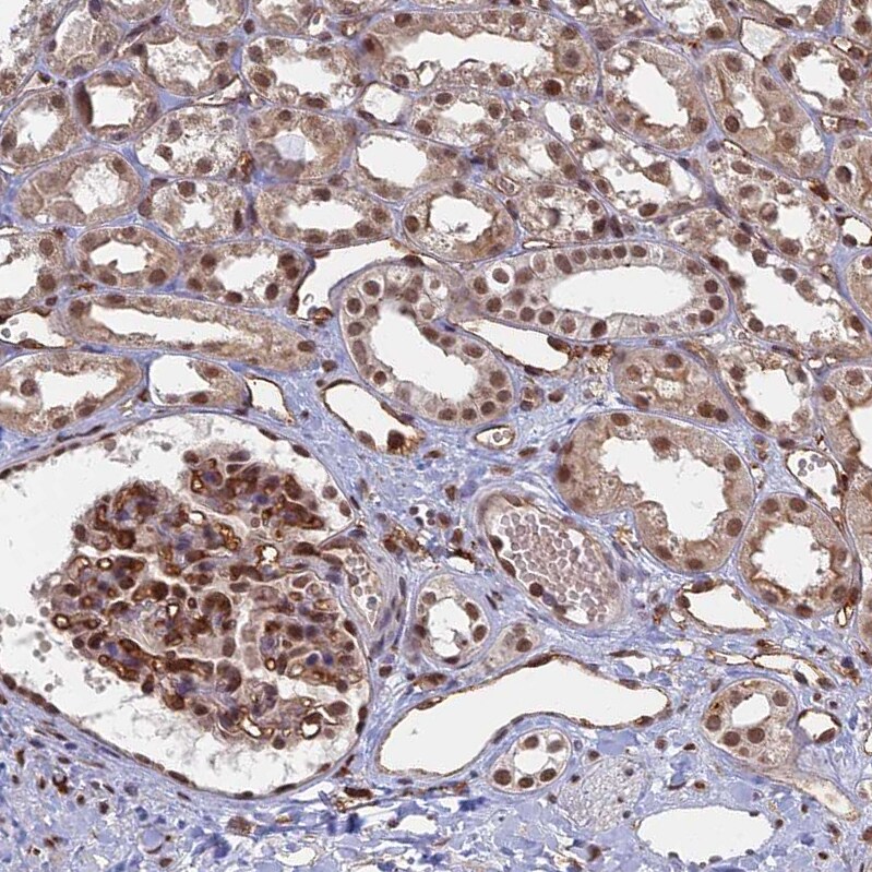 GPATCH1 Antibody - BSA Free Immunohistochemistry: GPATCH1 Antibody - BSA Free [NBP1-91958]