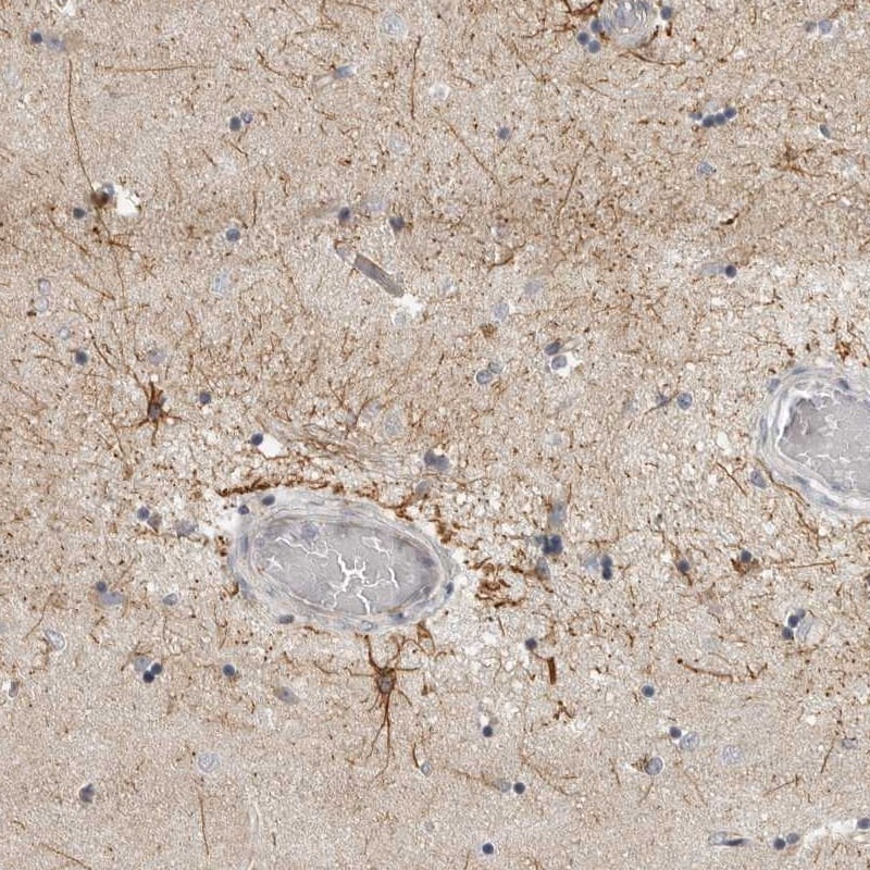 RXFP3/RLN3R1/SALPR Antibody - BSA Free Immunohistochemistry: RXFP3/RLN3R1/SALPR Antibody - BSA Free [NBP1-91963]