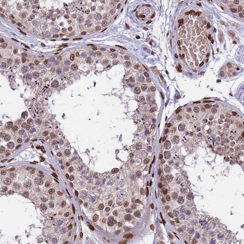 GPR135 Antibody - BSA Free Immunohistochemistry: GPR135 Antibody - BSA Free [NBP1-91965]