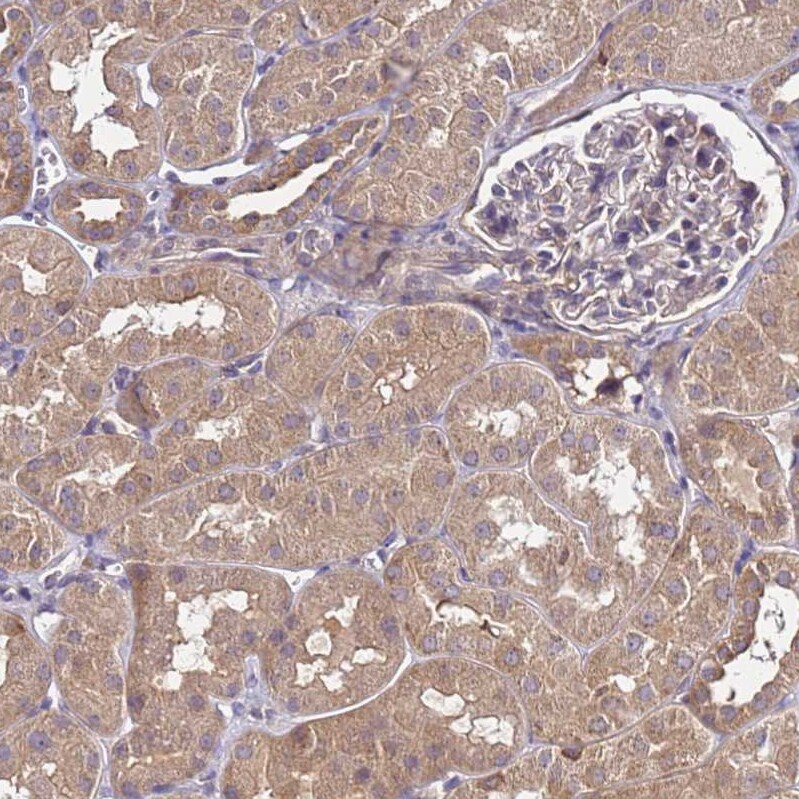 GSPT2 Antibody - BSA Free Immunohistochemistry: GSPT2 Antibody - BSA Free [NBP1-91971]